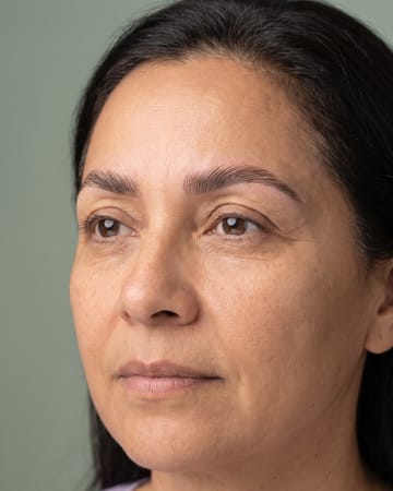 Brow lift sourcils clairsemés