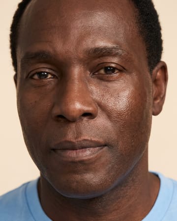 Homme : peau noire éclatante