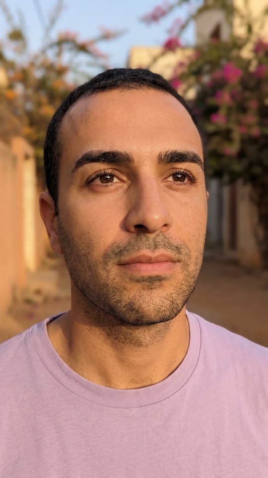 Microblading pour homme : Microblading d'homme cicatrisé : quelques traits fins comblent les vides ou une cicatrice, dans une forme droite et épaisse restée naturelle. Personne ne devine que c'est fait.